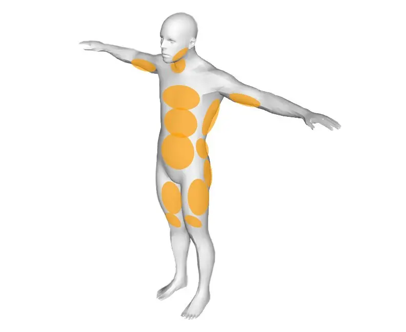 liposuction-treatment-areas